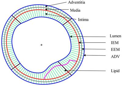 Comparison of multilayer and single-layer coronary plaque models on stress/strain calculations based on optical coherence tomography images